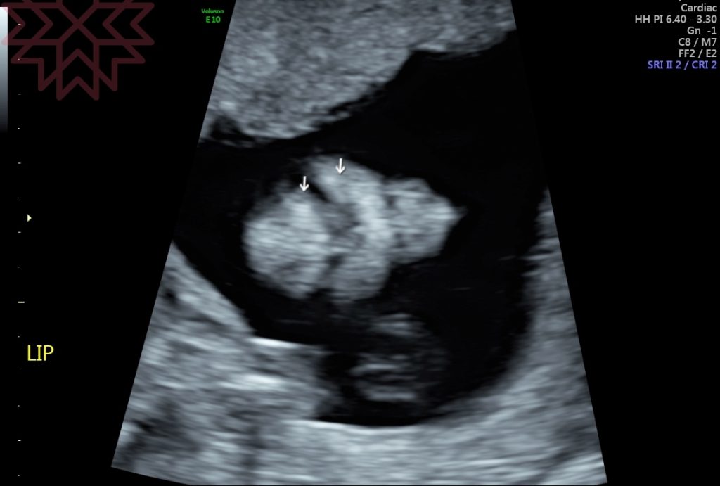 【懷孕21週】高層次超音波,4D超音波看到寶寶真面目,性別正式揭曉 @小環妞 幸福足跡