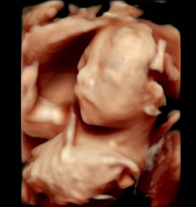 【懷孕21週】高層次超音波,4D超音波看到寶寶真面目,性別正式揭曉 @小環妞 幸福足跡
